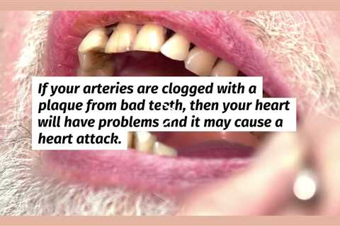 Six Health Problems That Can Arise from Bad Teeth - chengdds.com