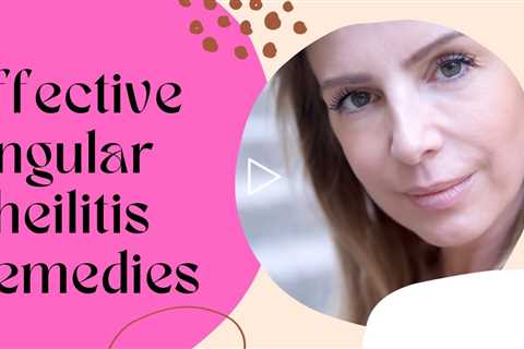 Effective Angular Cheilitis Remedies - Angular Cheilitis Remedies