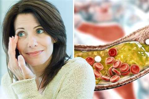 High cholesterol symptoms: Signs include blue, white, or light grey ring in your eye - Verve times