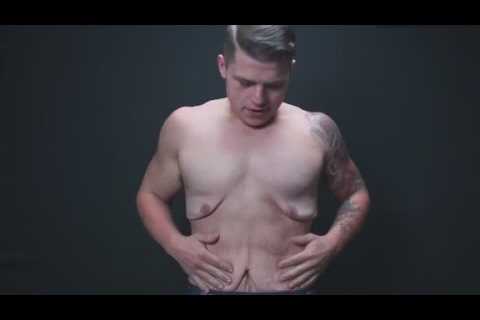 Man strips to show you loose skin after massive weight loss