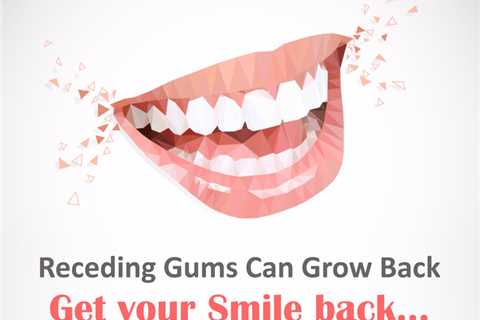 Most Effective Remedies To Regrow Receding Gums Naturally on Strikingly