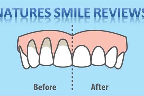 Grow Back Receding Gums With Natures Smile - Welcome to Teethfortheteaparty.com!