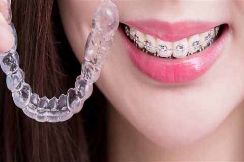 Invisalign which is better?