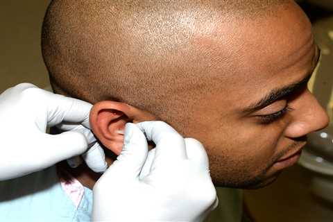 Propecia: Loss of hair, male baldness treatment. 