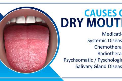 How do I know if I have dry mouth