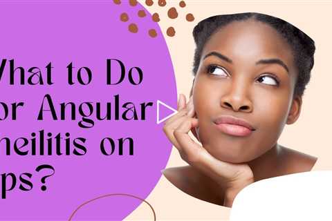 What to Do For Angular Cheilitis on Lips? - Angular Cheilitis Lips