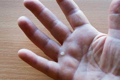 Ask the Experts: 'I Was Gardening and Got What Looks Like a Callus, But It's Not. What Is It?'