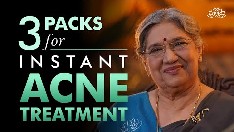 3 Best Face Pack for Acne Treatment Naturally | Home Remedies for Acne | How to Get Rid of Acne
