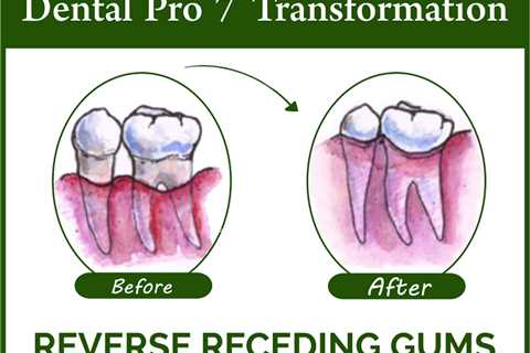 Dental Pro 7 Receding Gums