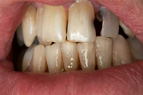 Can poor dental health make you sick?