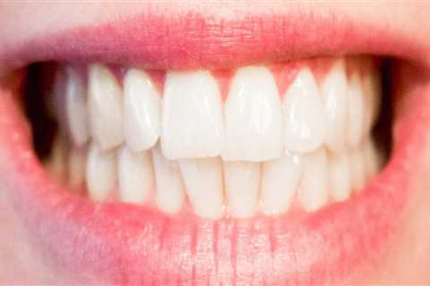 How do you know if your teeth are in good health?