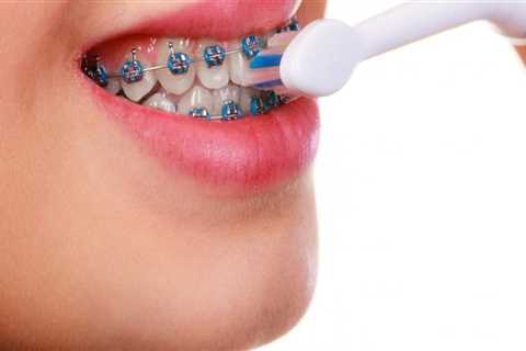 What counts as orthodontic treatment?