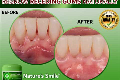 Reviews on Natures Smile