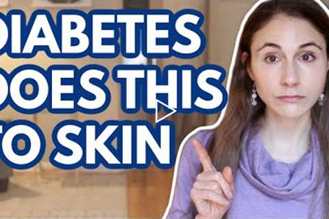 WHAT DIABETES DOES TO YOUR SKIN // DERMATOLOGIST @Dr Dray