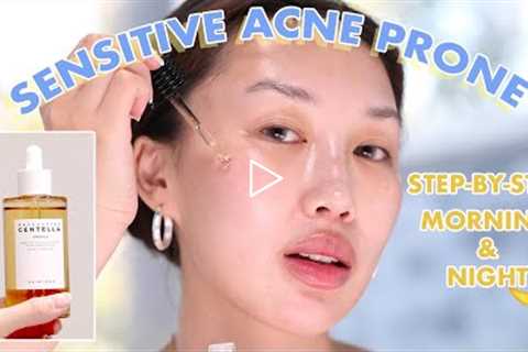 Korean Skincare for Acne Prone Skin *WHOLE ROUTINE*