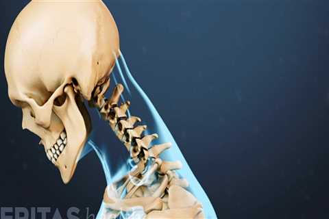 Will neck pain go away on its own?