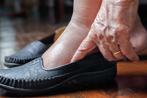 Do You Have Wide Feet? Here's Why You Should Avoid Patent Leather (and Other Tips)