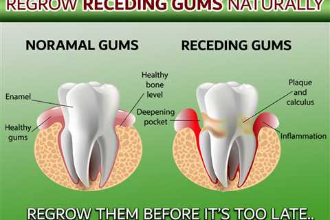natural gum healing