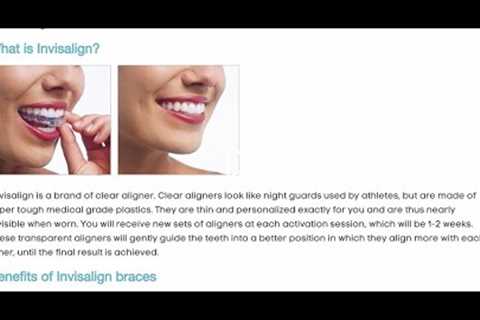 Invisalign Braces London - Forest & Ray - Dentists, Orthodontists, Implant Surgeons