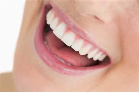 Is It Possible to Regrow Your Gums? - Receding Gums Treatment Options