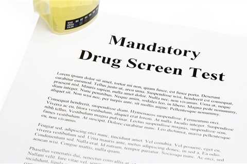 How long after taking delta 8 can you pass a drug test?