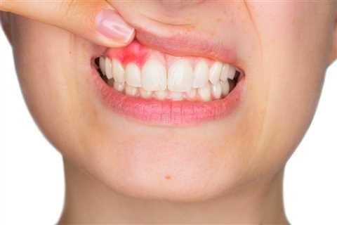 Why Do My Teeth Feel Loose? - All You Need To Know - TeethForBetterHealth.com