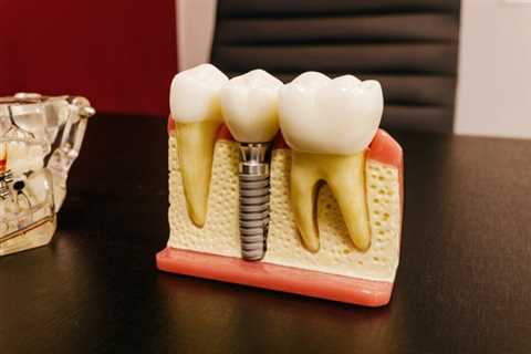 What are the Different Types of Dental Implants?