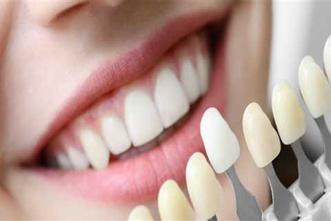 What is involved in cosmetic dentistry?