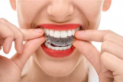 Can I Switch Dentists While Doing Invisalign Treatment?