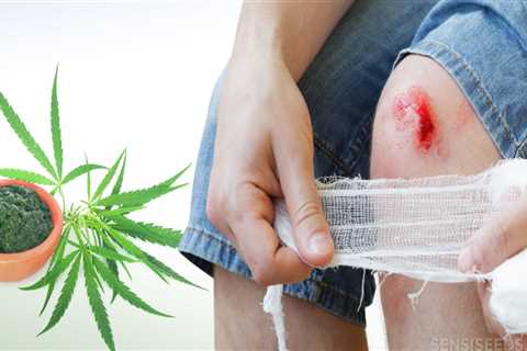 Can CBD Help Heal Wounds and Sores?