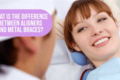 What is the Difference Between Aligners and Metal Braces?