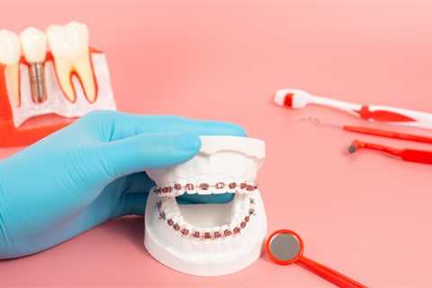 How to Evaluate an Orthodontic Practice?