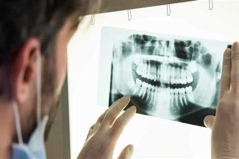 Are dental x-rays really necessary?