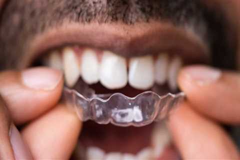 Can Clear Aligners Damage Teeth?
