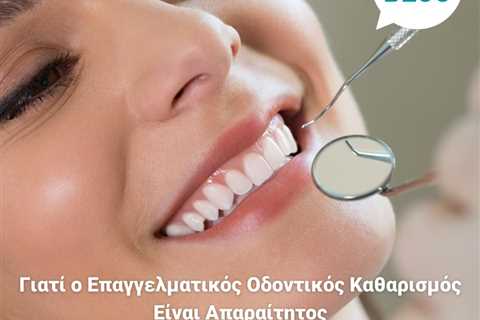 Standard post published to Smalto Dental Clinic at May 18, 2023 10:00