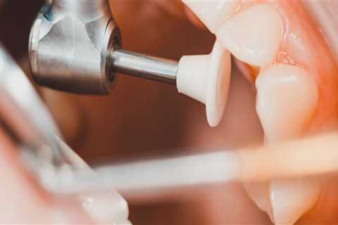 Finding Affordable Dental Health Care Treatments In Borger, TX