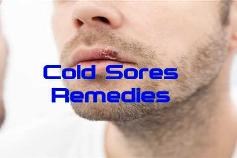 10 Home Remedies for Cold Sores - Home Remedies App