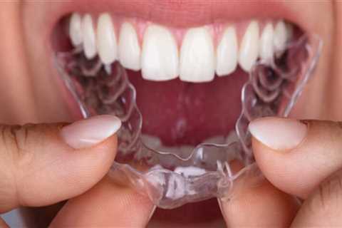 Achieve A Perfect Smile Discreetly: Exploring Invisalign Clear Braces In Sydney