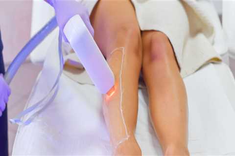 Are 4 laser hair removal sessions enough?