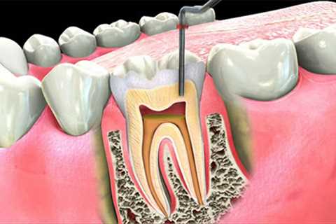 Standard post published to Symeou Dental Center at July 22, 2023 10:00