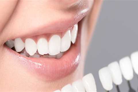 What is included in cosmetic dentistry?