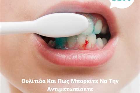 Standard post published to Smalto Dental Clinic at August 20, 2023 10:00
