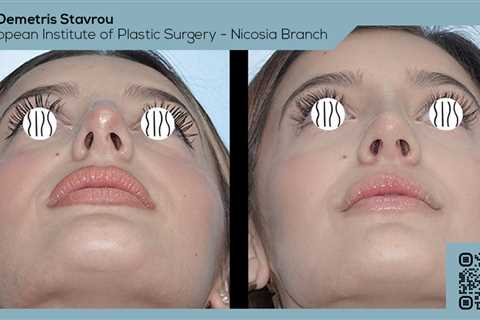 Standard post published to Dr. Demetris Stavrou - European Institute of Plastic Surgery - Nicosia..