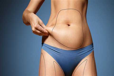 The Pros and Cons of Non-Invasive Fat Reduction