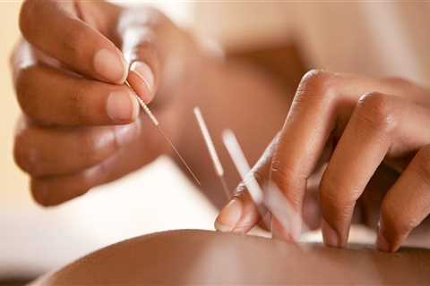Can I Receive Acupuncture If I Have a Bleeding Disorder or Take Blood Thinners?