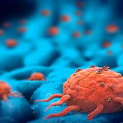 Immunotherapy Effectiveness Tied to Particular Cell Activity