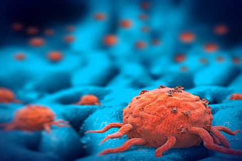 Immunotherapy Effectiveness Tied to Particular Cell Activity