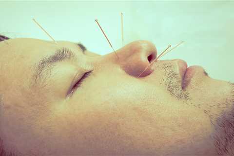 THE BENEFITS OF ACUPUNCTURE FOR ANXIETY AND DEPRESSION: A CLINICAL TRIAL