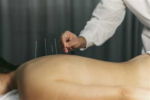 THE ROLE OF ACUPUNCTURE IN TREATING ANXIETY AND DEPRESSION IN ADOLESCENTS WITH CHRONIC PAIN AND..
