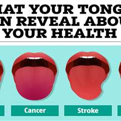 The 5 things your tongue can reveal about your health